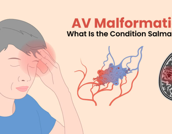 av malformation