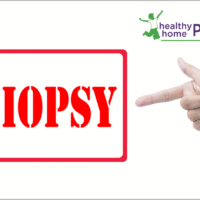 How to Protect Yourself from the Cancer Biopsy Racket