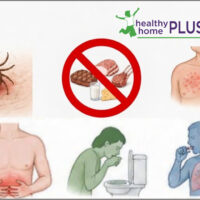 Reversing Alpha-Gal Syndrome (Natural Treatment Achieves 95% Remission of Meat/Dairy Allergy!)