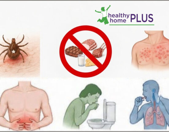 Reversing Alpha-Gal Syndrome (Natural Treatment Achieves 95% Remission of Meat/Dairy Allergy!)